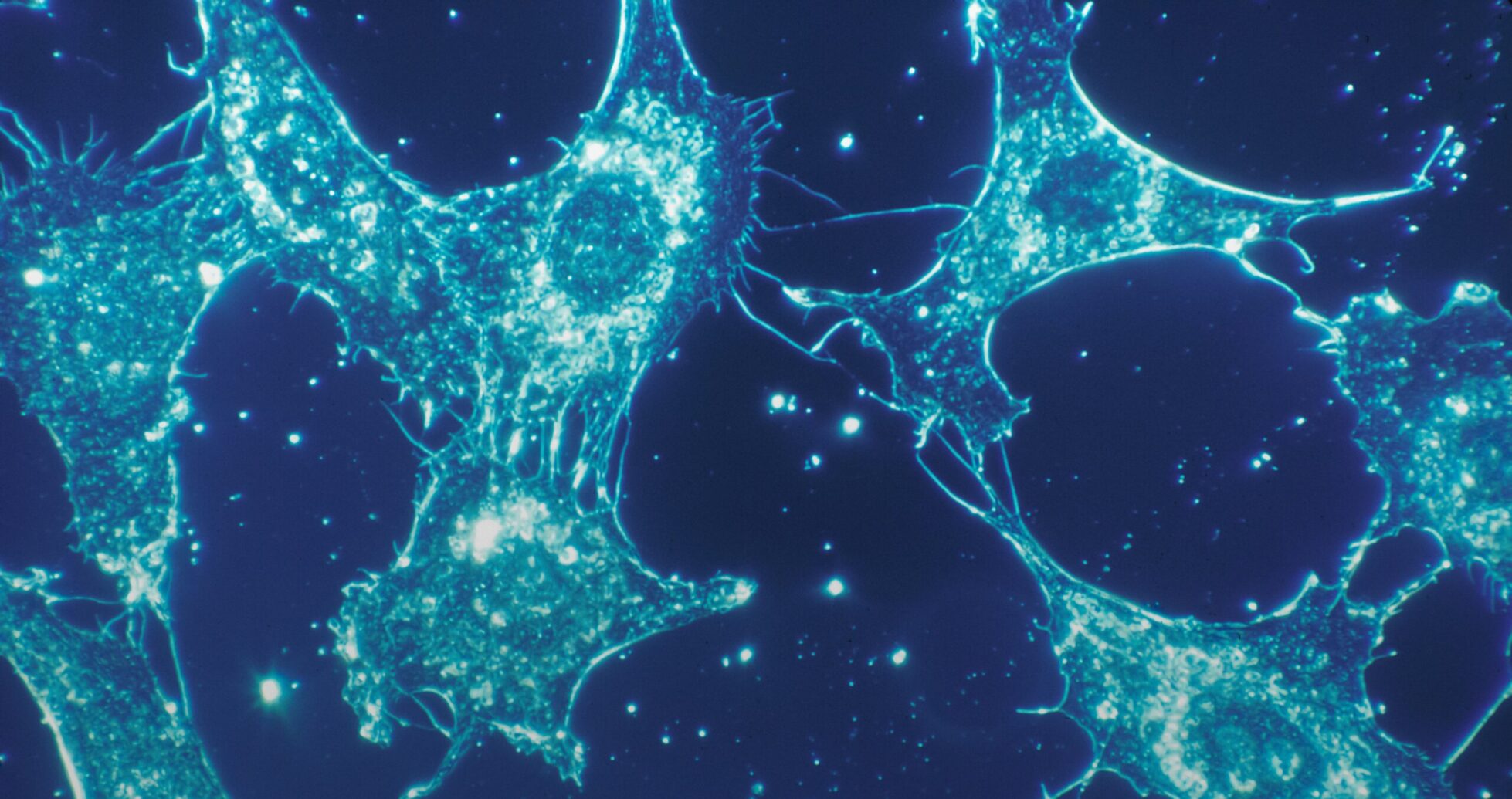 Normal cells of human connective tissue in culture at a magnification of 500x